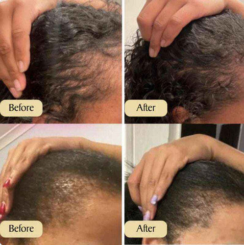 Image of Hair Growth Oil 60ml