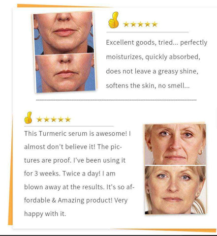 Image of Beauty Lights Turmeric Serum